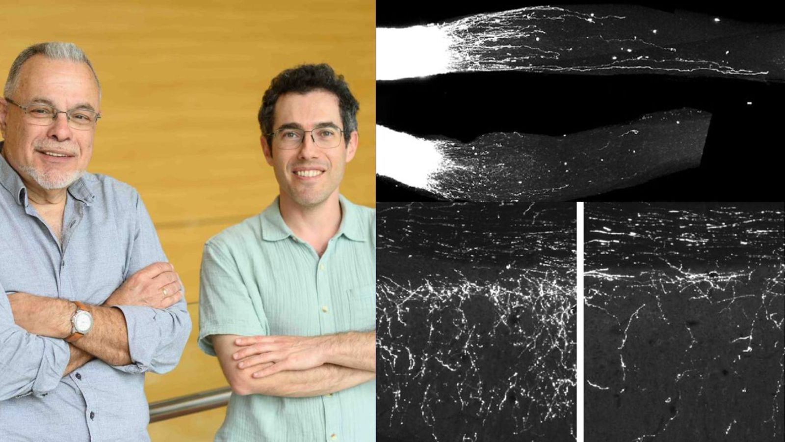 La scienza al Weizmann non si ferma: scoperte molecole di RNA in grado di rigenerare i nervi