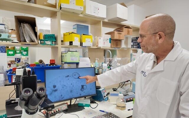 Medicina rigenerativa, a Tel Aviv coltivato in laboratorio il primo rene umano artificiale