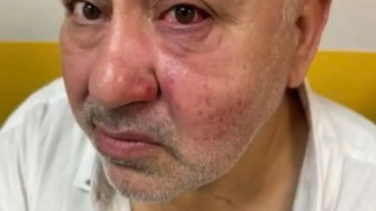 Allarme antisemitismo in Francia: dall’aggressione di Livry-Gargan a un’ondata di violenza