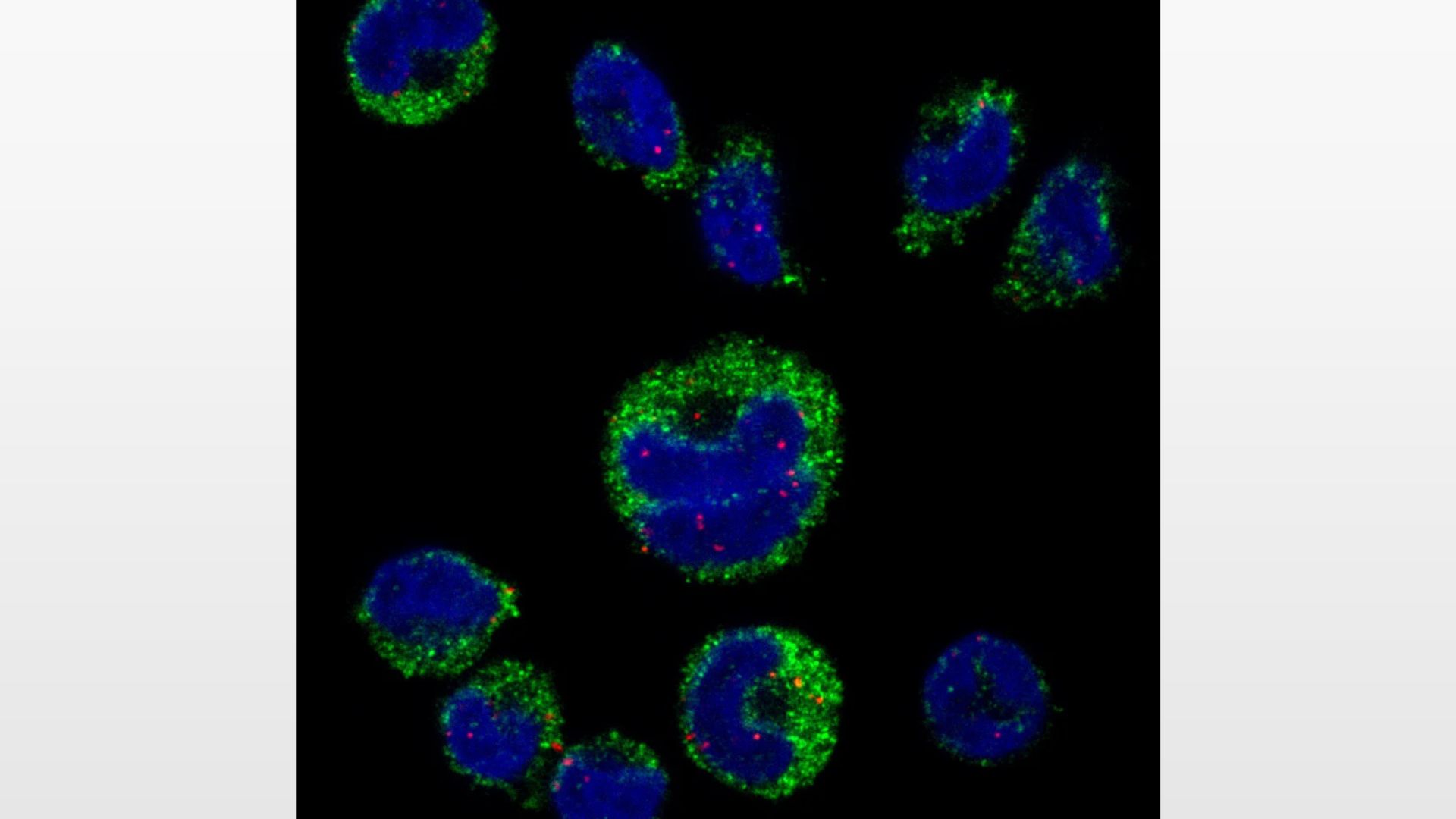 Ricerca israeliana: come il parassita della malaria inganna il sistema immunitario Ricerca israeliana: come il parassita della malaria inganna il sistema immunitario