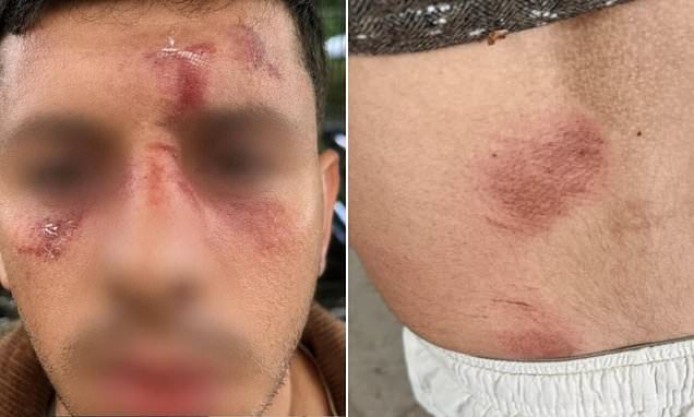 “Sei ebreo?”: giovane israeliano aggredito a Golders Green